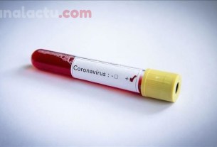 Image d'illustration test coronavirus Sénégal.