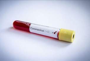 Image d'illustration resultat test covid.